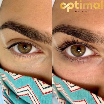 Laser Aesthetics Center - Before and after! - Medical Spas Near Me - Sleepy Hollow, New York Laser Aesthetics Center - Before and after! - Medical Spas Near Me - Sleepy Hollow, New York