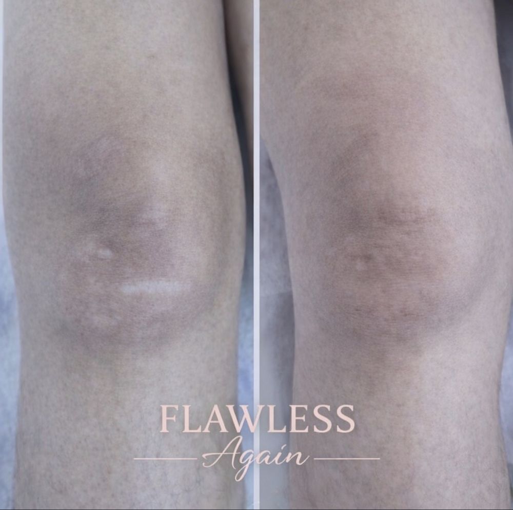 Flawless Again Logo