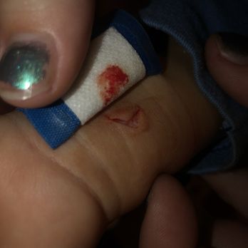 Funbox Arcadia - Their employee, CELESTE, did this to a two year old! Taking off a wrist band and put a bandaid like it's nothing !! - Indoor Playcenter Near Me - Arcadia, California Funbox Arcadia - Their employee, CELESTE, did this to a two year old! Taking off a wrist band and put a bandaid like it's nothing !! - Indoor Playcenter Near Me - Arcadia, California