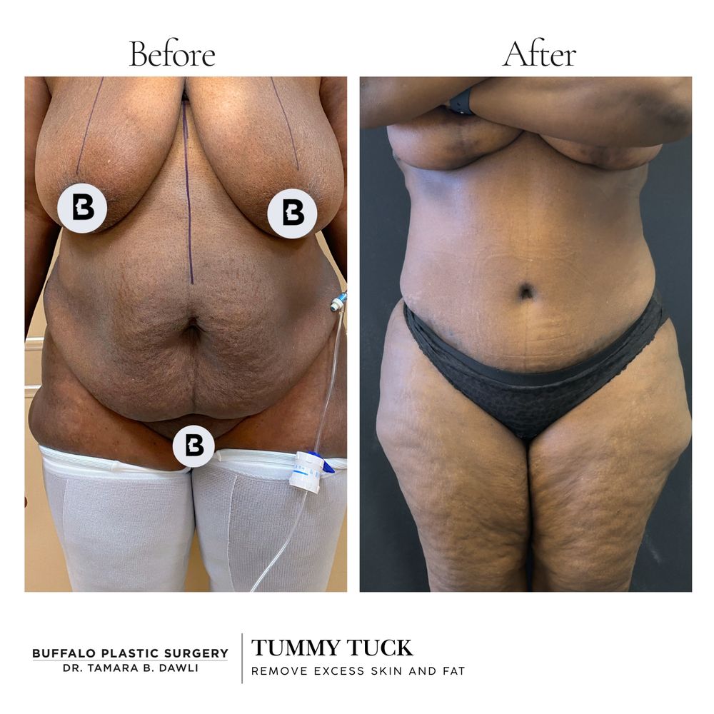 Buffalo Plastic Surgery Logo