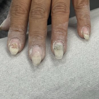 Color Nails - So I got fills and I ended up getting an infection. I don't think I will be coming back to this place. - Nail Salons Near Me - Las Vegas, Nevada Color Nails - So I got fills and I ended up getting an infection. I don't think I will be coming back to this place. - Nail Salons Near Me - Las Vegas, Nevada