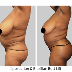 Lexington Plastic Surgeons