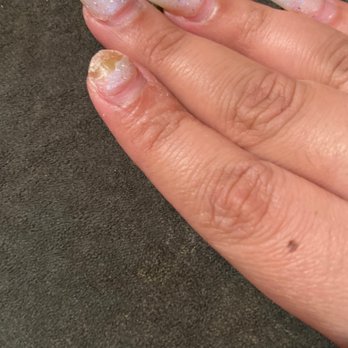 4 Nails & Beauty - Nail fungal - Nail Salons Near Me - Queens, New York 4 Nails & Beauty - Nail fungal - Nail Salons Near Me - Queens, New York