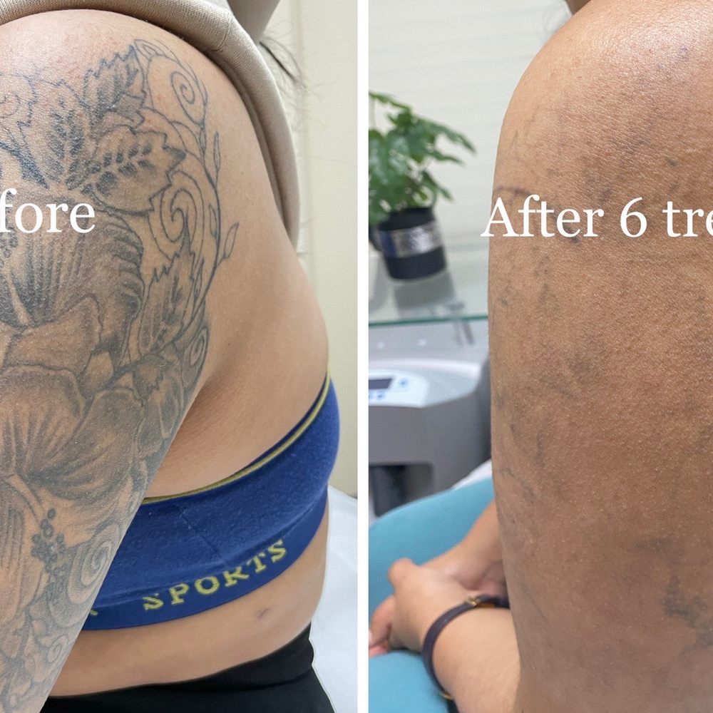 Bared Monkey Laser Spa - Laser Hair Removal Near Me - New York, New York Bared Monkey Laser Spa - Laser Hair Removal Near Me - New York, New York