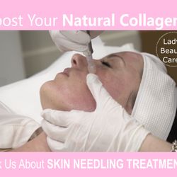 Lady's Beauty Care - Skin Needling treatments available @ www.ladysbeautycare.com.au