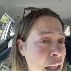 Honey Bunny Brazilian Wax - The terrible job she did