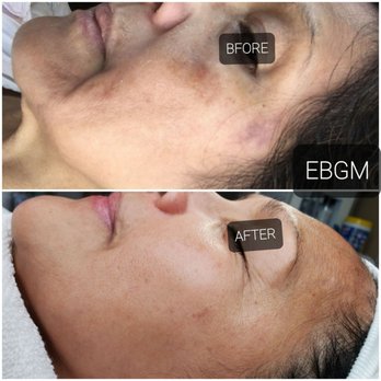 Esthetique by Grace M - Estheticians Near Me - Northridge, California
