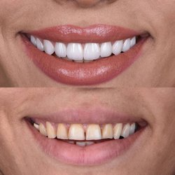West Covina Perfect Smile Dentistry