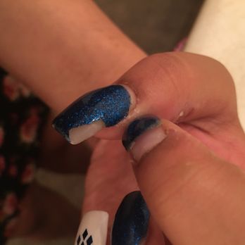 Ruby Nail Spa - Chipped paint, loose nail - Nail Salons Near Me - Merced, California