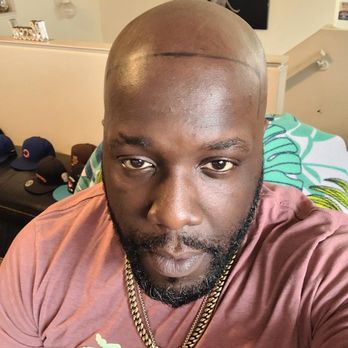 LV Scalp King - Hair Loss Centers Near Me - Las Vegas, Nevada LV Scalp King - Hair Loss Centers Near Me - Las Vegas, Nevada