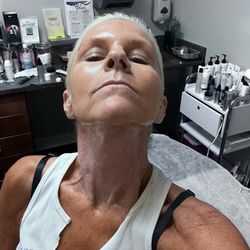Dani was excellent doing the microneedling on my neck. Amazing results and very knowledgeable at her job. Totally recommend!