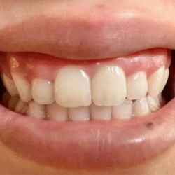 Palm Orthodontics