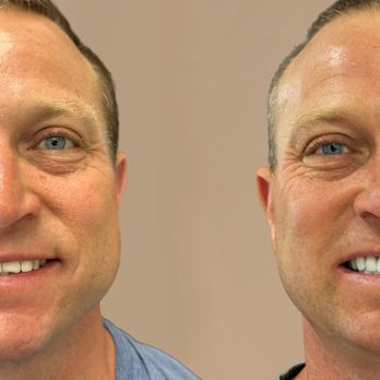 Dover Dental - Cosmetic dentistry with porcelain veneers - General Dentistry Near Me - Newport Beach, California Dover Dental - Cosmetic dentistry with porcelain veneers - General Dentistry Near Me - Newport Beach, California
