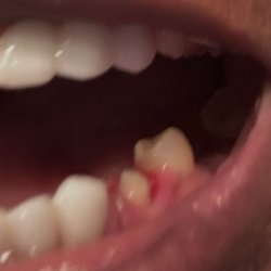 Wohlers Family Dentistry