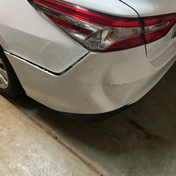 Dent Star - Before - Mobile Dent Repair Near Me