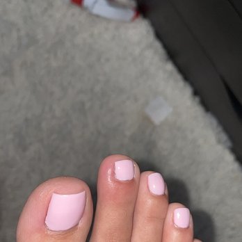 Be My Nails - Infected toenail on other foot - Nail Salons Near Me - Milpitas, California