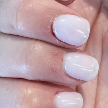 Shiloh Nails & Spa - Bad aggressive manicure with lots of bleeding- picture taken 1 hour after visit - Nail Salons Near Me - Windsor, California Shiloh Nails & Spa - Bad aggressive manicure with lots of bleeding- picture taken 1 hour after visit - Nail Salons Near Me - Windsor, California