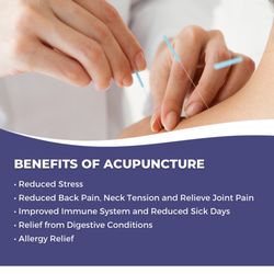 SDR Healing Acupuncture - Lots of benefits of Acupuncture