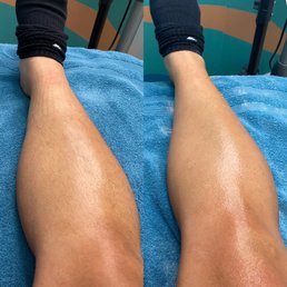Before & after. Before & after.