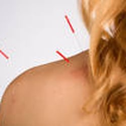 Acupuncture and Allergy Testing Clinic