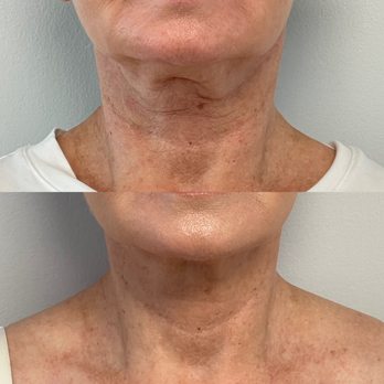 Clinique Derma MD - Aestheticians Near Me - Brossard, Quebec Clinique Derma MD - Aestheticians Near Me - Brossard, Quebec