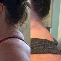 Sunny Massage - Upper back/neck before and after comparison.