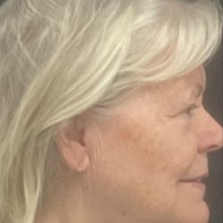 Esthetica Orange County