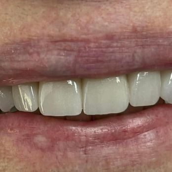 Michael W King, DDS - General Dentistry Near Me - Jackson, Tennessee Michael W King, DDS - General Dentistry Near Me - Jackson, Tennessee
