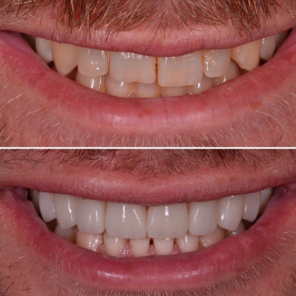 CARSON DENTAL & COSMETIC CENTRE 18 Photos & 62 Reviews Cosmetic