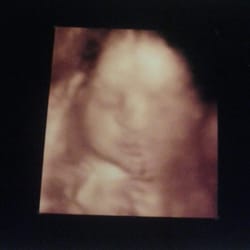Baby's First Ultrasound
