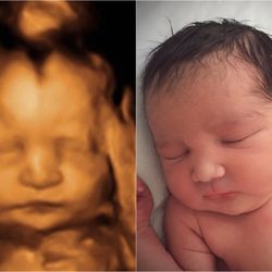 California Prenatal Imaging 100 Photos 132 Avis Radiologie Monterey Rd Morgan Hill Ca Etats Unis Numero De Telephone