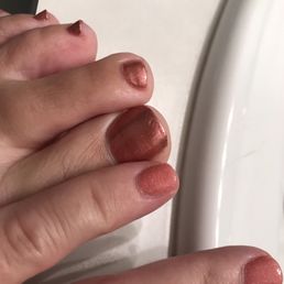 Toes don't match fingers