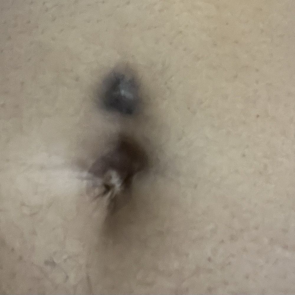 My piercing placed above the navel My piercing placed above the navel
