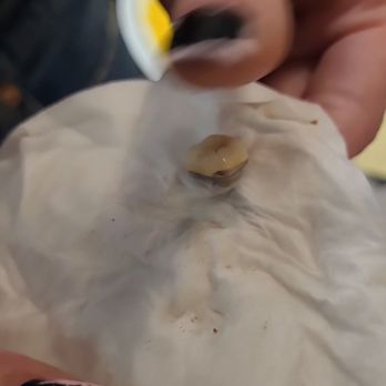 Waffle House - The tooth. - Diners Near Me - Murfreesboro, Tennessee