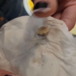 The tooth.