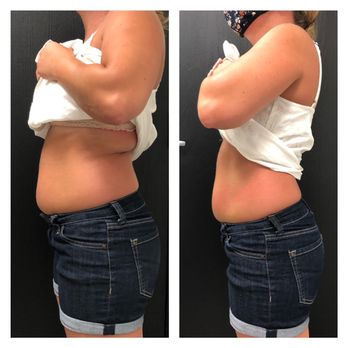 Blading by Ericka - Cryoslimming - Permanent Makeup Near Me - Redlands, California
