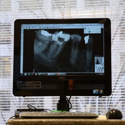 Advanced Endodontic Associates - Digital Radiographs