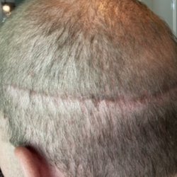 Advanced Medical Hair Institute