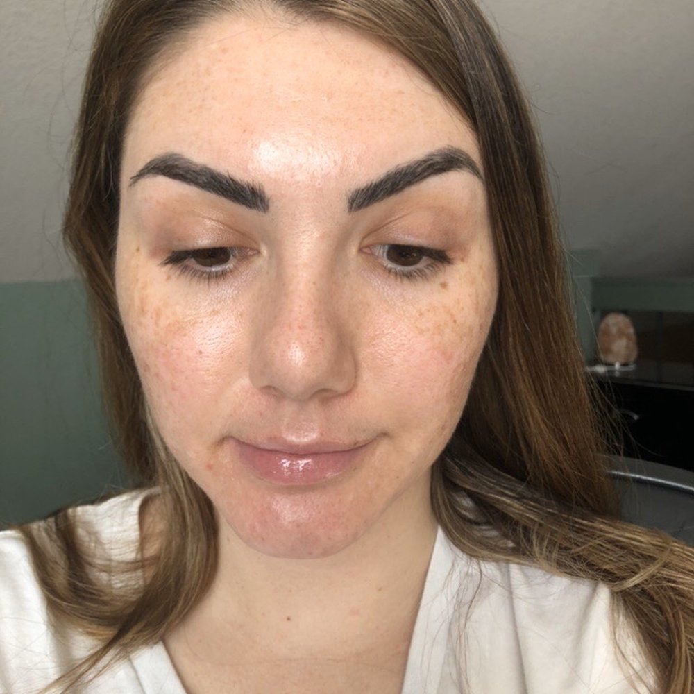 Ethereal Day Spa - AFTER facials - Skin Care Near Me - Temecula, California