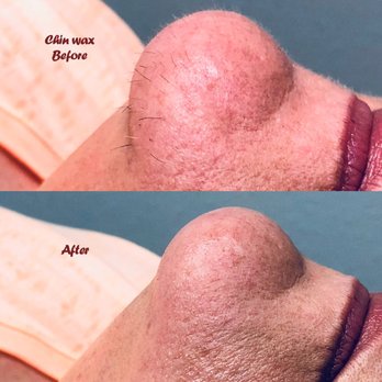 Kiki's Esthetics - Chin wax - Estheticians Near Me - Vancouver, Washington Kiki's Esthetics - Chin wax - Estheticians Near Me - Vancouver, Washington