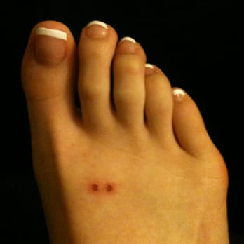 K3 Nails And Spa - Reassuring to know that I'm not the only one with bite marks from heels thanks to Lan - Nail Salons Near Me - Milpitas, California