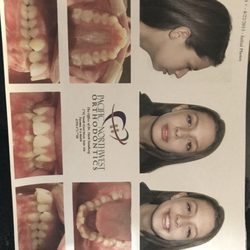 Pacific Northwest Orthodontics - Before