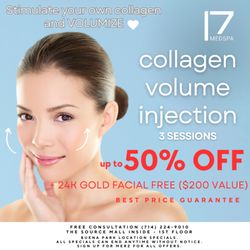 17 MedSpa - March '24 Sale!
Volumize your face with collagen injections!