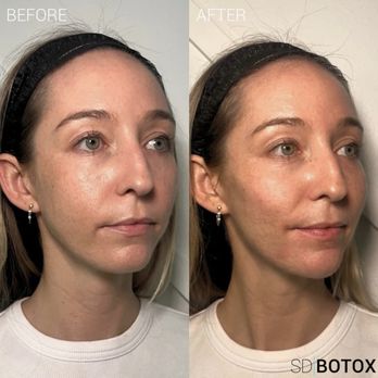 SD Botox - Medical Spas Near Me - Killeen, Texas SD Botox - Medical Spas Near Me - Killeen, Texas