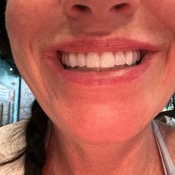 Advanced Dental Care of Shady Road - Happy teeth!