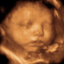 Photo of Prenatal Ultrasound of Glendale