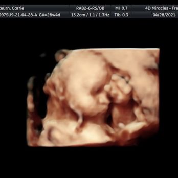 4D Miracles - Ultrasound Imaging Centers Near Me - Fremont, California 4D Miracles - Ultrasound Imaging Centers Near Me - Fremont, California