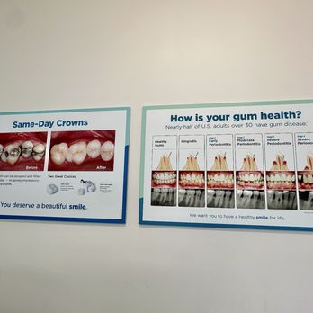 NoHo Modern Dentistry - Helpful visuals on crowns and gum health--made it easier to understand what was going on with my teeth. - General Dentistry Near Me - North Hollywood, California NoHo Modern Dentistry - Helpful visuals on crowns and gum health--made it easier to understand what was going on with my teeth. - General Dentistry Near Me - North Hollywood, California