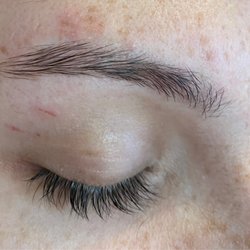 Miracle Eyebrows - The cuts on my lid and bruising above my eyebrow. I have never been bruised from threading not have I ever been sliced by their thread.