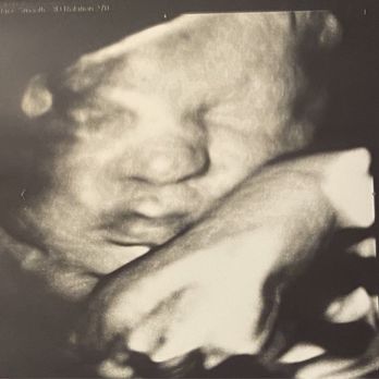 Take A Peek Boutique - Ultrasound Imaging Centers Near Me - Gilroy, California Take A Peek Boutique - Ultrasound Imaging Centers Near Me - Gilroy, California